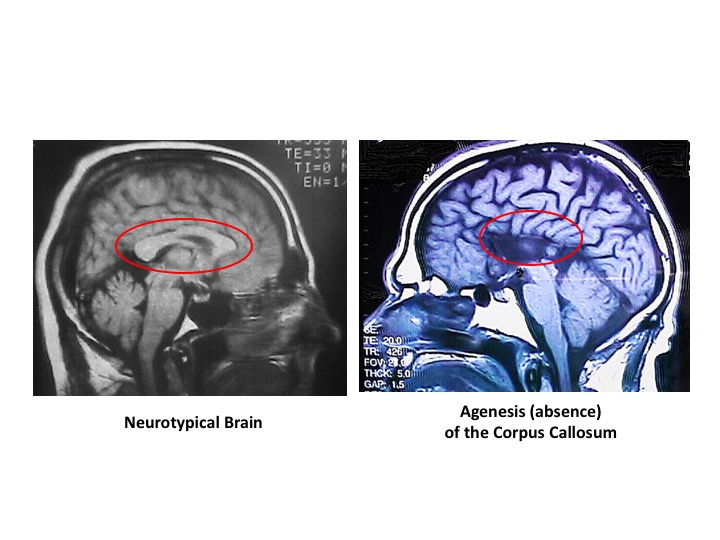 brain scans